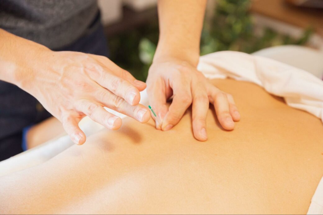 Acupuncture needle with snake venom is placed in back